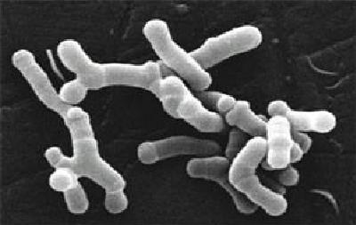 Bifidobacterium_longum_en_microscopie_électronique